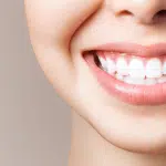 WHITER TEETH