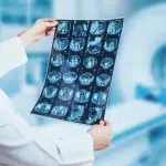 GUM DISEASE MAY RAISE RISK OF SOME CANCERS