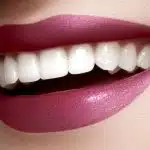 HOW TO MAKE TEETH LOOK BETTER