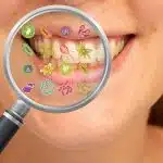 PERIODONTAL BACTERIA REDUCE ORAL DEFENSES